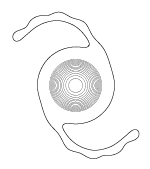 Sulcoflex - Trifocal